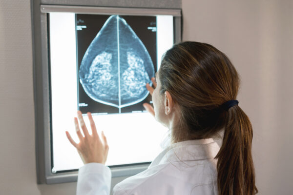 Breast Texture Patterns May Aid Risk Prediction from Mammography 1706.jpeg