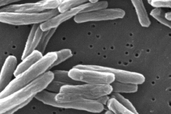 Tuberculosis case confirmed at Portland middle school, health officials say 67ddd2ce6bc964.77059078.jpeg
