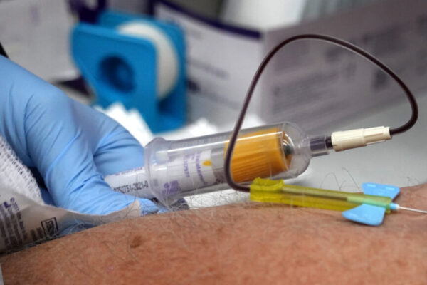 Alzheimer’s blood test from Fujirebio Diagnostics approved by FDA Gettyimages 1290912964 1024x576.jpg