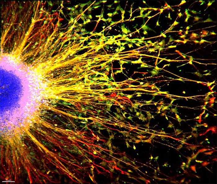 Brain organoid.jpg