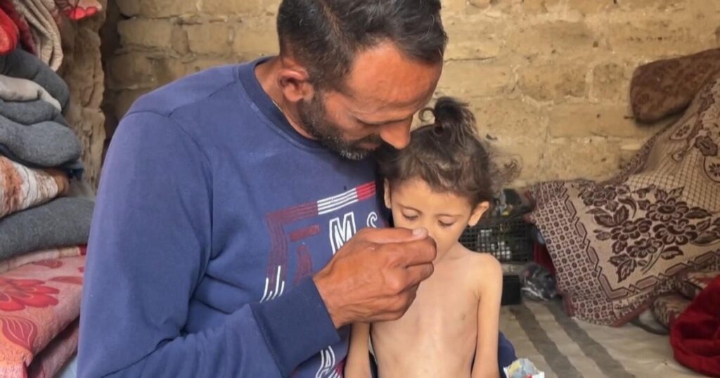 Cbsn fusion 6 year old girl in gaza weighs just 13 pounds amid growing starvation crisis thumbnail.j.jpeg