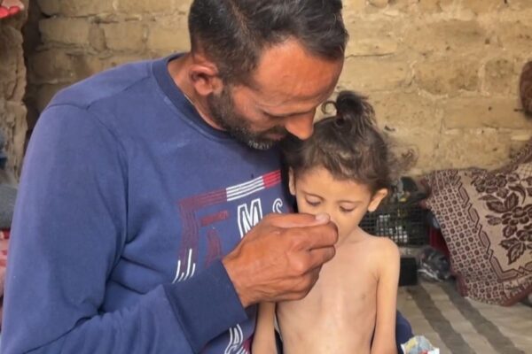 Cbsn fusion 6 year old girl in gaza weighs just 13 pounds amid growing starvation crisis thumbnail.j.jpeg