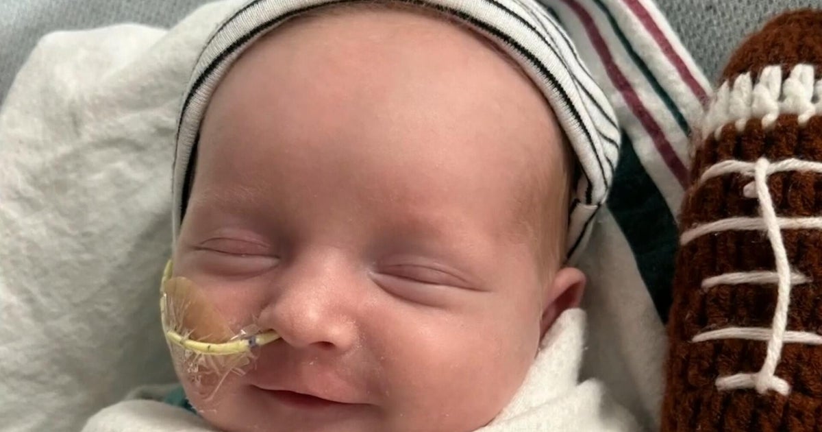 Cbsn fusion promising new gene therapy treats baby with rare genetic disorder in medical first thumb.jpeg
